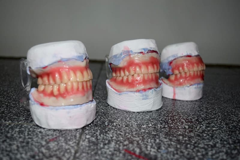 DIF Estatal hizo entrega de 50 prótesis dentales 1 DIF Estatal hizo entrega de 50 prótesis dentales