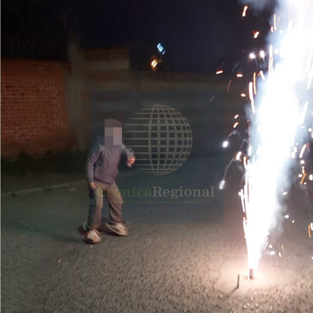 Explota pirotecnia en bolsillo de un niño en El Rosario; sufre quemaduras en el 20% del cuerpo