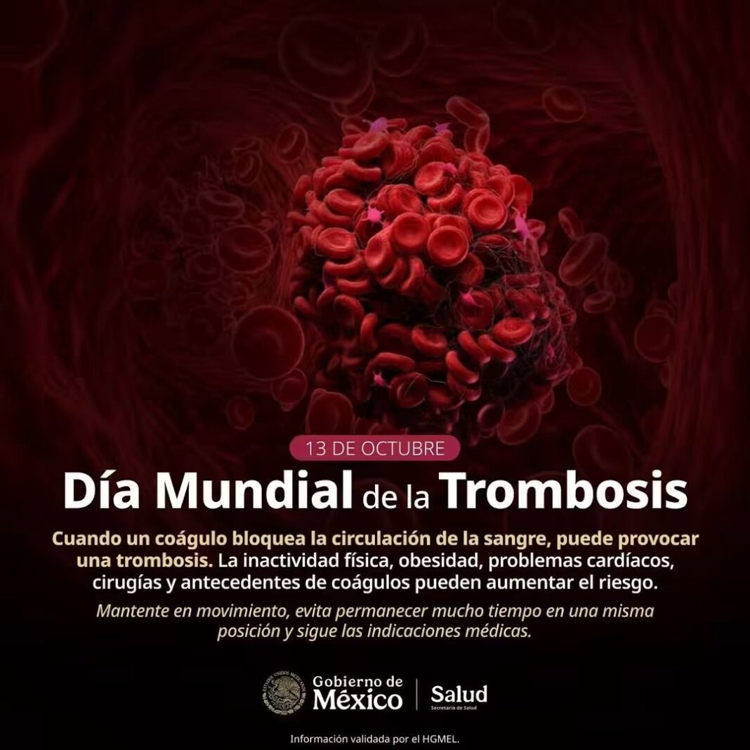 Querétaro difunde prevención de trombosis venosa y embolia pulmonar
